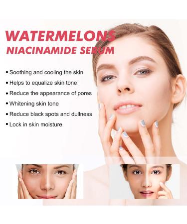 3-Part Watermelon Glow Niacinamide Set | Dew Drops Moisturizer Serum & Brightening Toner | Hydrating Skincare Essentials - Buy Online on GoSupps.com