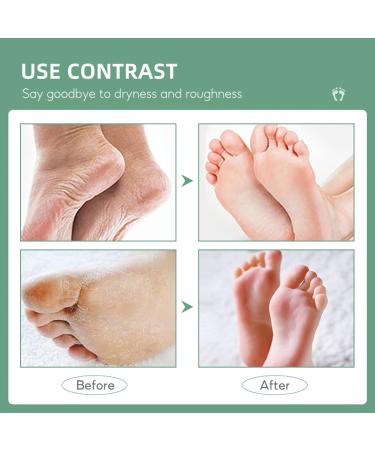 Urea 40% Foot Cream - Cracked Heel Repair Cream - Foot Cream for Cracked Heels and Dry Skin - Urea Cream for Feet with Tea Tree Oil Aloe Vera and Chamomile for Deep Moisturizing - Buy Online on GoSupps.com