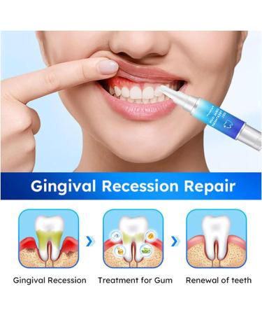 Furzero Oral Gum Treatment Gel Dentizen Gum Therapy Gel Furzero Gum Therapy Gel Gum Shield Therapy Gel Furzero Teeth Whitening Repair Regrowth Gel (4pcs) - Buy Online on GoSupps.com