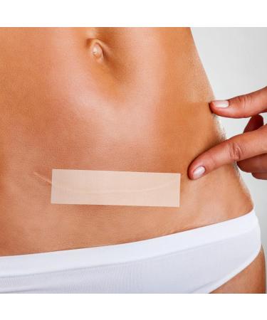 NOLITOY 2pi ces Autocollants Gel Pour Cicatrices Bandes Adh sives Pratiques Pour Soins Peau Utilisables Pour Adultes - Buy Online on GoSupps.com