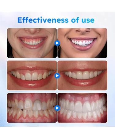 Furzero Oral Gum Treatment Gel Dentizen Gum Therapy Gel Furzero Gum Therapy Gel Gum Shield Therapy Gel Furzero Teeth Whitening Repair Regrowth Gel (4pcs) - Buy Online on GoSupps.com