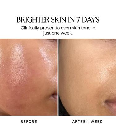 HERBIVORE Nova 15% Vitamin C + Turmeric Brightening Serum for Dark Spots Hyperpigmentation + Even Skin Tone | Vegan Plant-Based Cruelty-Free 30 mL / 1 oz 1 Fl Oz (Pack of 1) Nova Serum - Buy Online on GoSupps.com