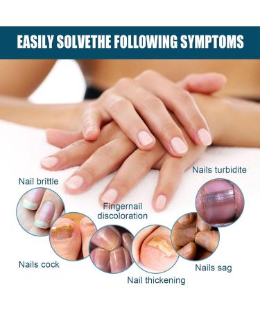 Nail Repair Cream for Damaged Nails | Strengthener for Thin & Cracked Nails | Boost Growth & Strengthen Weak Nails - Buy Online on GoSupps.com