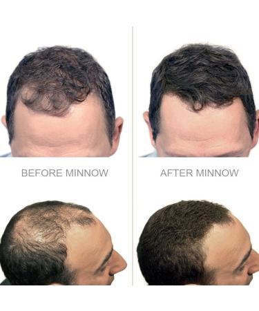 Natural Hair Loss Concealer - Hair Building Fibers for Men and Women 0.87oz (Black) - Buy Online on GoSupps.com