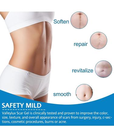 Reusable Silicone Scar Sheets - Medical Grade Tape for Scar Removal - 1 Nude Soft Scar Strips for Surgery, C-section, Burns, Acne, Keloid - Easy-Tear 1.6'' x 60 - Buy Online on GoSupps.com