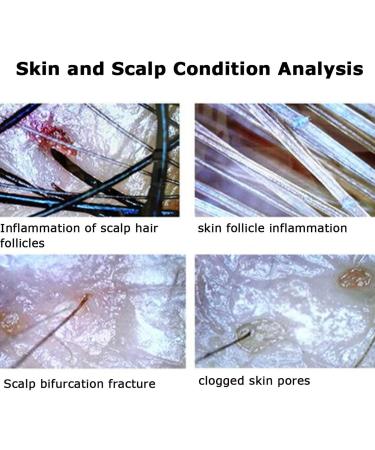 Skin Diagnosis Hair Analyzer 10.1inch Screen Multi Functional High Definition Rechargeable Skin Scalp Hair Follicle Detector High Sensitivity Digital Hair Follicle Skin Analyser Machine - Buy Online on GoSupps.com