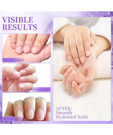 Sassytip Stylo Repousse-Cuticules L'huile 2 ml Stylo 2 En 1 Pour Dissolvant De Cuticules Huile Pour Ongles Aux Parfums Rose Et Lavande Huile Cuticules Ongles Pour Soin De Manucure Des Femme Et Fille - Buy Online on GoSupps.com