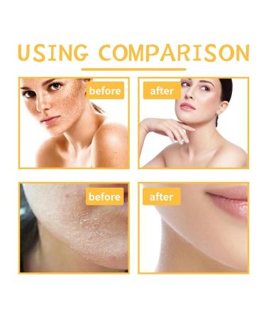 Turmeric Brightening Body Scrub for Dark Inner Thighs, Bikini Area & Underarms - Sea Salt Exfoliation for Hyperpigmentation Treatment & Dark Spots (1PC) - Buy Online on GoSupps.com