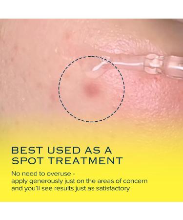 MIMUMIMU Dark Spot Remover Serum for Face | Korean Clinic Skincare - Thioctic Acid 0.01% & Niacinamide 5% | Spot Treatment for Melasma Hyperpigmentation Discoloration Acne Scars | 30ml/1.01 fl.oz 1pc - Buy Online on GoSupps.com