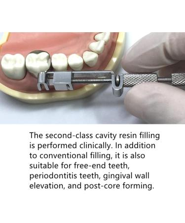 Dental Partial Matricular System Set - 40 Tooth Matrices & Matrix-Tofflemire Holder for Perfect Curvature | International Shipping - Buy Online on GoSupps.com