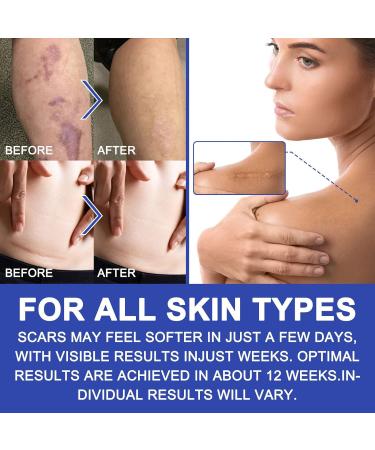 Silicone Scar Sheets 1.6x120 - Scar Removal Tape for Burn, Acne, C-Section & Surgery - Reusable & Washable - Buy Online on GoSupps.com