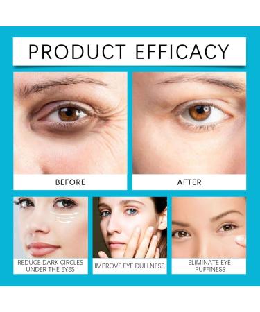 Retinol Under Eye Cream Instant Lift Plus Dark Circles - Instant Firm Eye Tightener Anti Aging Eye Cream for Dark Circles and Puffiness Eye Bags Treatment Skin Care Hydrates & Lifts (1) - Buy Online on GoSupps.com