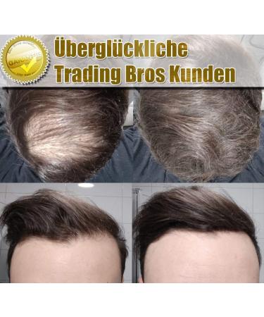 XXL Premium Loose Hair Powder | Hair Thickening Magic Fibers - Dark Blonde 28g | International Shipping Available - Buy Online on GoSupps.com