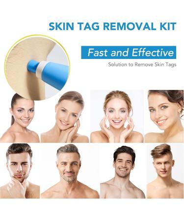 Skin Tag Tool Kit 2 in 1 Upgrade For Small to Large Skin Tags (2-8mm) Painless Fast and Easy Skin Tag Removal Kit Tools with 40 Removal Bands & 10 pcs Cleansing Wipes Easy to Use - Blue - Buy Online on GoSupps.com