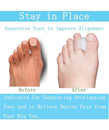 MENOCADY 12-Pack Gel Toe Separator for Bunions - 1/4 Thick Big Toe Spacers - Single Loop Toe Spreader for Overlapping Toe Correction (Clear) - Buy Online on GoSupps.com