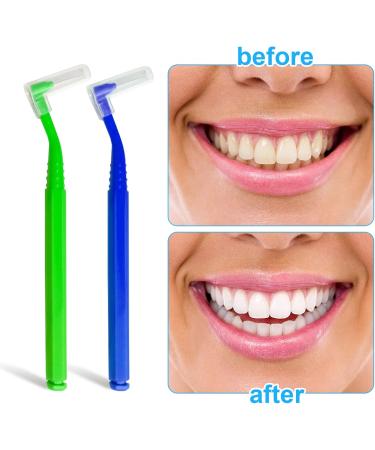 Skhaovs 25 Interdental Brushes Gap Brush for Teeth & Gums Non-Slip Handle Braces Cleaning 5 Colors - Universal Oral Care - Buy Online on GoSupps.com
