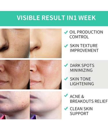 35% Glycolic Acid Pads for Face & Body Exfoliating AHA Resurfacing Pads with Vitamins B5 C & E and Green Tea for Fine Lines & Wrinkles 50 Count - Buy Online on GoSupps.com