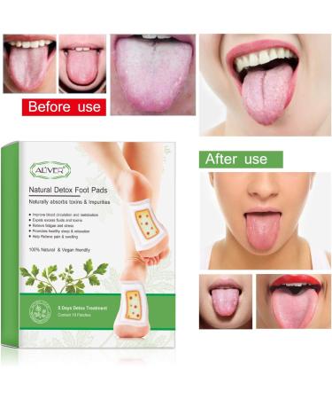 Detox Foot Pads - 20 Natural Organic Foot Patches for Improved Sleep & Blood Circulation | Remove Toxins! - Buy Online on GoSupps.com