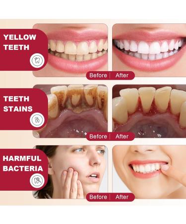  Opilroyn Toothpaste For Sensitive Teeth - Deep Cleaning Toothpaste Anti-Tartar Toothpaste 120G Toothpaste For Teeth Cleaning Odor Remover Toothpaste To Strengthen Teeth - Buy Online on GoSupps.com