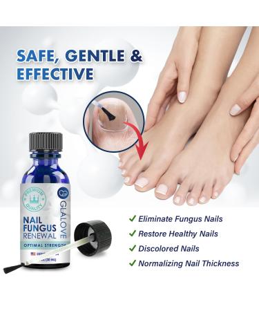 Extra Strength Toenail Fungus Treatment - Fast Acting Home Solution for Healthy Nails | Repair & Renew Damaged Toenails in One Week - Buy Online on GoSupps.com
