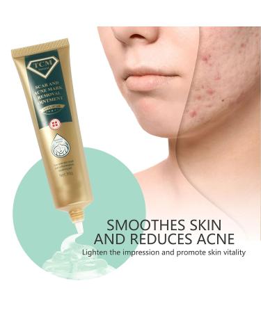 Scar Removal Cream - 30g - Fade Scars, Stretch Marks & Burns - Moisturizing Facial Skin Repair Treatment - Buy Online on GoSupps.com