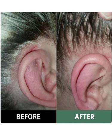 3 pi ces Lissima Gommage Naturel Pour Cuir Chevelu Nettoyant En Profondeur Et Nourrissant Hydratant Et Confortable Formule Douce Pour Tous Les Types De Cheveux - Buy Online on GoSupps.com