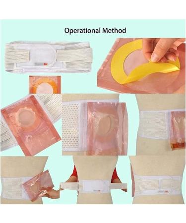 Samnuerly Strong Comfortable Stoma Hernia Belt - Breathable Belly Bandage & Clip Abdominal Tape (Size L) | Best Hernia Support - Buy Online on GoSupps.com