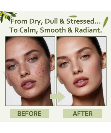 Ozonated Olive Oil Fully Ozonated Oil for Face & Body Organic Extra Virgin Ozone Oil for Hydration Soothing Comfort Irritated-Skin Support & Blemish-Prone Skin Care Skin-Recovery Support 2 oz - Buy Online on GoSupps.com