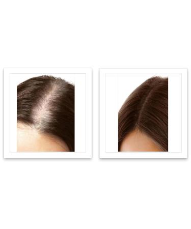 Buy Caboki 10X Volumizing Hair Powder - Dark Brown | Talc-Free Root Touch Up for Thinning Hair Covers Bald Spots & Gray for Men & Women - Buy Online on GoSupps.com