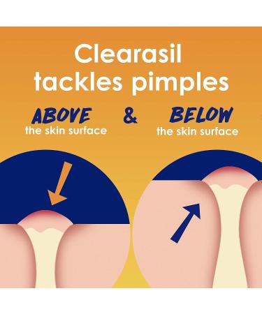 Clearasil Stubborn Acne Control 5in1 Exfoliating Wash Maximum Strenght with 2% Salicylic Acid Acne Treatment Medicine Daily Acne Facial Cleanser 6.78 fl oz (Pack of 2) - Buy Online on GoSupps.com