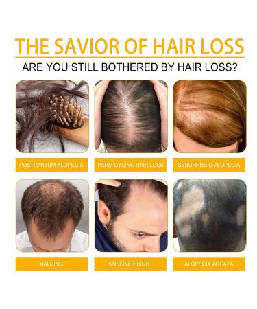 Nchampionba Allurium Hair Growth Serum with Chebe for Black Women - Revitalize Thinning Hair - 2pcs - Buy Online on GoSupps.com