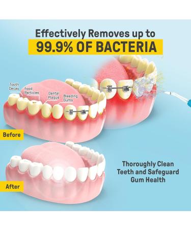 Remi Cordless Water Flosser - Portable Rechargeable Oral Irrigator with 5 Modes & Nozzles | Effective Tartar & Plaque Remover (Charcoal - Buy Online on GoSupps.com