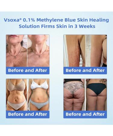 TLOPA 0.1% Methylene Blue Skin Healing Solution Methylene Blue Drops for Healthy Skin Anti-Aging Fullbody Moisturize (1) - Buy Online on GoSupps.com