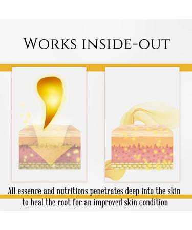 Seed Spring 24K Gold Eye Mask - Hydrating Collagen Patches for Dark Circles, Puffiness, and Wrinkles - 30 Pairs - Buy Online on GoSupps.com