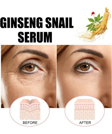 Korean Ginseng & Snail Mucin Serum Essence 30ml | Korean Skincare Repair & Revive Serum - Buy Online on GoSupps.com