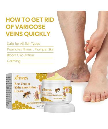 Furzero Bienengift Varicose Veins Cream - Best Spider Vein Relief & Pain Relief Salve (1 Piece) - Shop Internationally - Buy Online on GoSupps.com