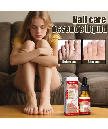 YNPQTDS Nail and Toenail Strengthening Liquid - 10ml Ingrown Toenail Corrector Drops | Beauty Care for Hands and Feet - Nighttime Travel-Friendly for Dry Damaged Cracked Curved Fragile and Chipped Nails - Buy Online on GoSupps.com
