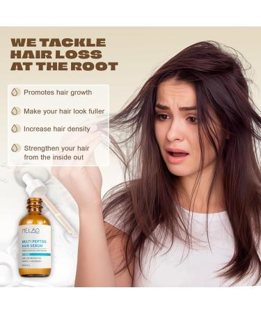 S rum Croissance Cheveux Anti-Chute & Repousse Capillaire S rum Actif pour la Pousse des Cheveux Texture L g re Pour Tous Types Pour Hommes & Femmes - Buy Online on GoSupps.com