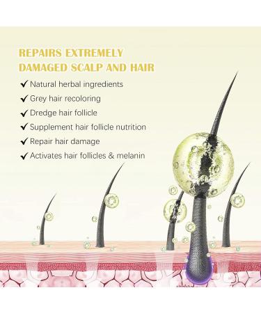 5% Minoxidil Hair Growth Oil for Men & Women | Stronger Thicker & Healthier Hair Regrowth Serum | Natural Nourishing Hair Oil | Moisturizes Scalp & Hair - 2.02 oz - Buy Online on GoSupps.com