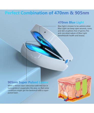 iKeener Portable Cold Laser Nail Fungus Treatment - Rechargeable Home Care Device for Painless Onychomycosis Cure - Buy Online on GoSupps.com