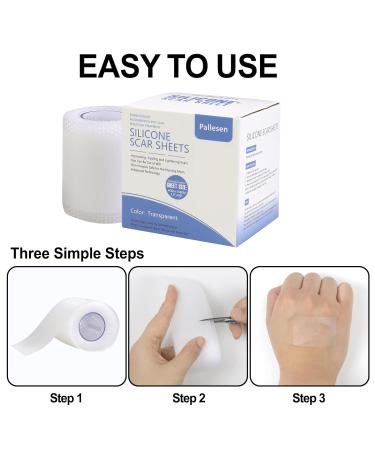 Silicone Scar Sheets & Tape - 1.6 x 60 for Surgical C-Section Tummy Tuck & Acne Scar Treatment - Buy Online on GoSupps.com