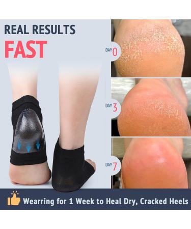 Cracked Heel Treatment Repair Socks - Premium Padded Compression Gel Sleeves for Dry Feet - 2 Pairs Spa Moisturizing Socks (One Size Fits Most - Buy Online on GoSupps.com