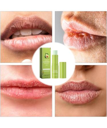  Ziennhu Repairing Lip Balm - Shea Butter - Repairs & Soothes - Chapped and Damaged Lips - Repair Lip Balm - Moisturizing Lip Balm - Repairing Lip Balm - Shea Butter - Repairs - Buy Online on GoSupps.com