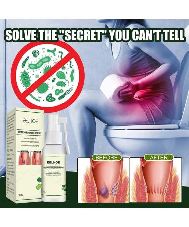ANRUI 2Pack Herbal Hemorrhoids Spray - Natural Relief for Hemorrhoids (2PCS) - Buy Online on GoSupps.com