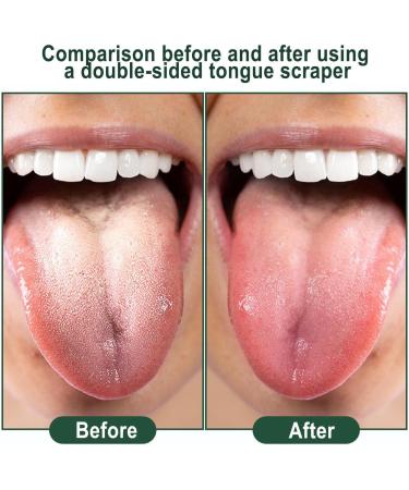 Pacienjo Tongue Brush - 4 Pack Silicone Tongue Cleaner for Fresh Breath & Healthy Oral Hygiene | International Shipping Available - Buy Online on GoSupps.com