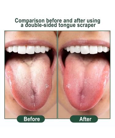 Tongue Scraper Set - 4 Silicone Dental Tongue Cleaners for Fresh Breath & Oral Hygiene - Buy Online on GoSupps.com