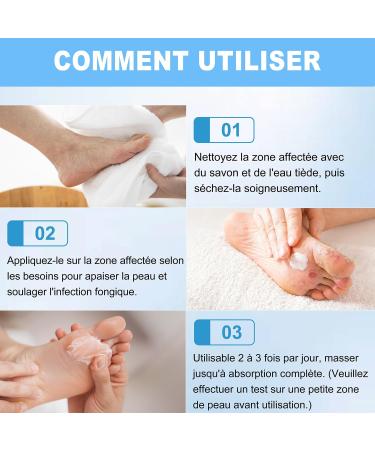Cr me Antifongique 20 g - Cr me antifongique pour la peau soin quotidien pour la peau sujette la mycose pied - Buy Online on GoSupps.com