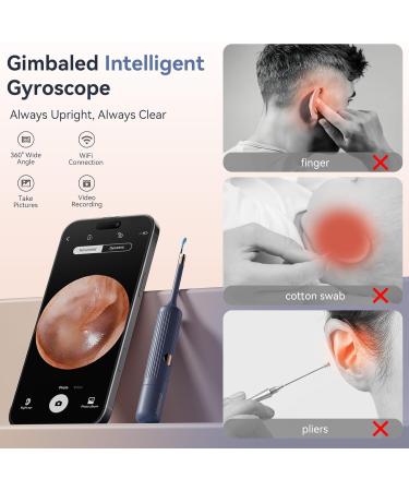 Ear Wax Removal Tool Camera: ZERONDER Ear Cleaner with Flexible Ear Scope - Visual Camera 1080P HD for Adults & Kids - Safe Ear Cleaning Tool for Home Use White - Buy Online on GoSupps.com