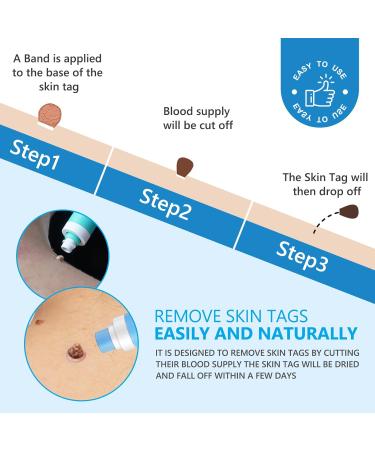 Kit Pour L' Limination Des Taches Cutan Es - Upgraded Skin Tag Removal Avec 36 Patchs De R Paration De La Peau - Action Rapide Et S Re - Petite Grande Taille (1-9mm) Pour Le Visage Et Le Corps - Buy Online on GoSupps.com