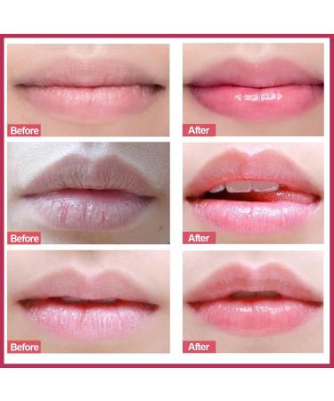 MIELIKKI Strawberry Lip Scrub | Exfoliator for Chapped & Dry Lips | Sugar Lip Polish & Moisturizer | Best Lip Care Products - Buy Online on GoSupps.com